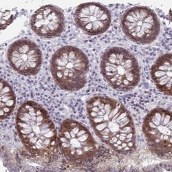 ACF Antibody, Novus Biologicals 0.1mL; Unlabeled:Antibodies, Polyclonal